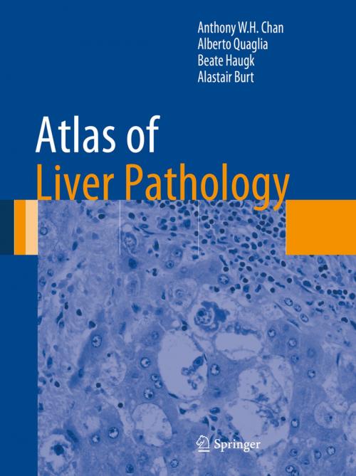 Cover of the book Atlas of Liver Pathology by Alberto Quaglia, Beate Haugk, Alastair Burt, Anthony W.H. Chan, Springer New York
