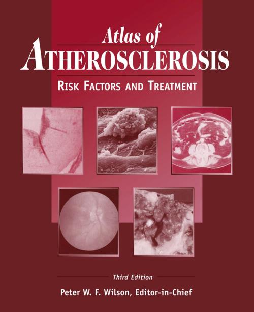 Cover of the book Atlas of Atherosclerosis by , Current Medicine Group
