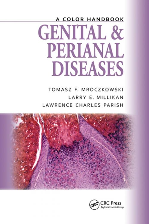 Cover of the book Genital and Perianal Diseases by Tomasz F. Mroczkowski, Larry E. Millikan, Lawrence Charles Parish MD, CRC Press