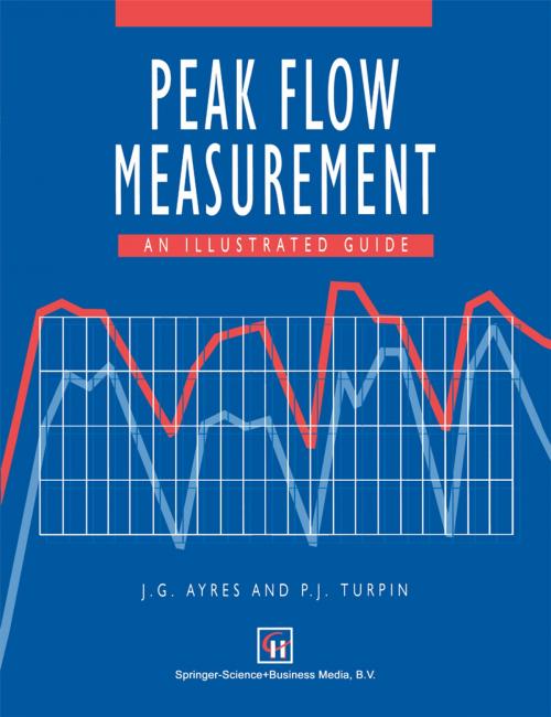 Cover of the book Peak Flow Measurement by J. G. Ayres, P. J. Turpin, Springer US