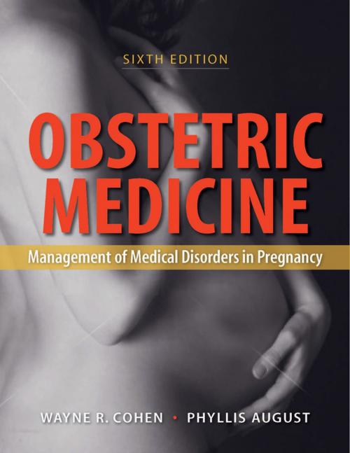 Cover of the book Obstetric Medicine, 6e by Wayne R. Cohen, Phyllis August, PMPH USA, Ltd.
