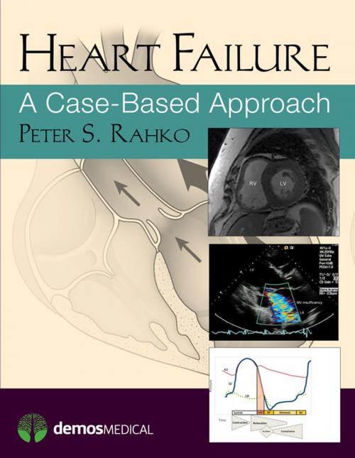 Cover of the book Heart Failure by Peter Rahko, MD, Springer Publishing Company