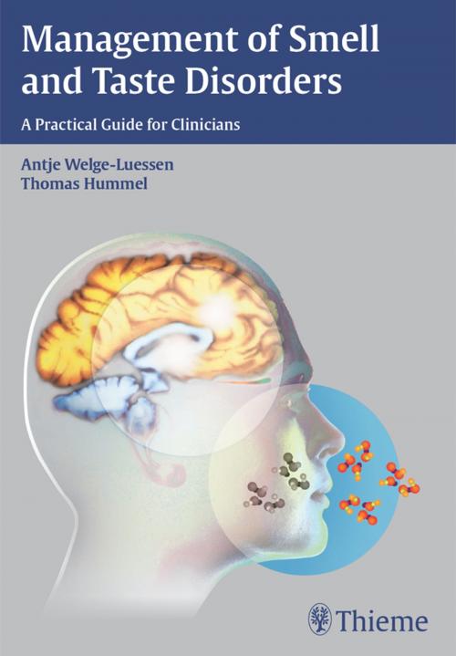 Cover of the book Management of Smell and Taste Disorders by Antje Welge-Luessen, Thomas Hummel, Thieme