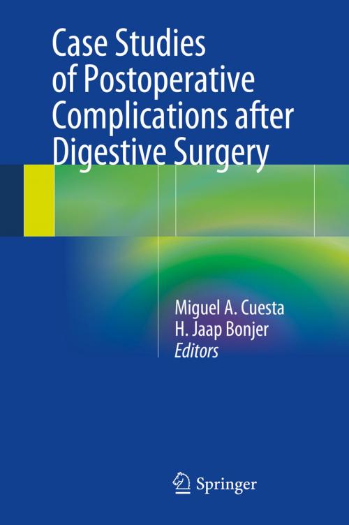 Cover of the book Case Studies of Postoperative Complications after Digestive Surgery by , Springer International Publishing