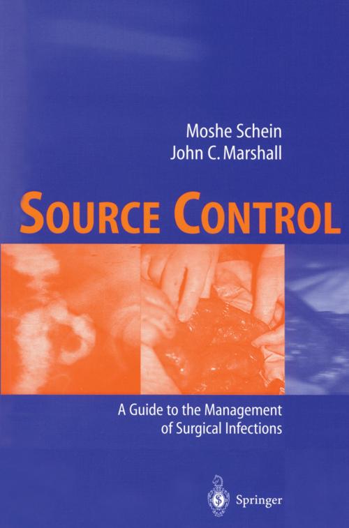 Cover of the book Source Control by John C. Marshall, Moshe Schein, Springer Berlin Heidelberg