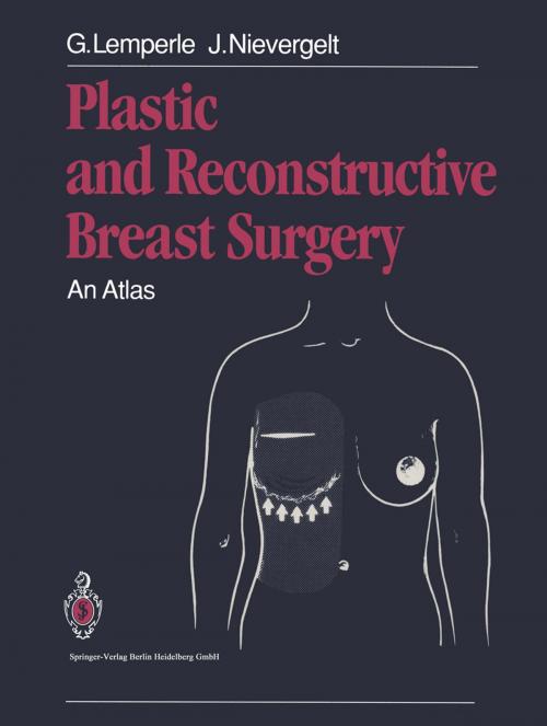Cover of the book Plastic and Reconstructive Breast Surgery by Jürg Nievergelt, Gottfried Lemperle, Springer Berlin Heidelberg