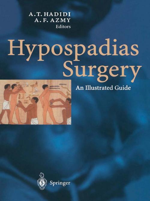 Cover of the book Hypospadias Surgery by , Springer Berlin Heidelberg
