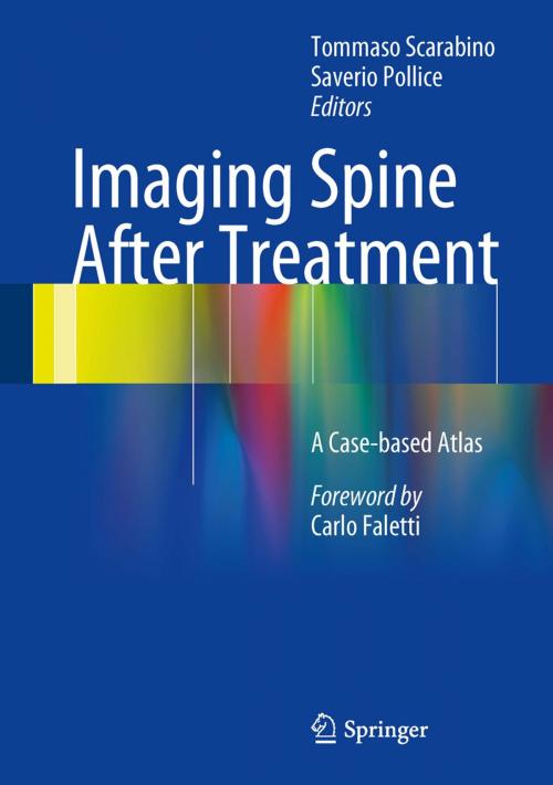 Cover of the book Imaging Spine After Treatment by , Springer Milan