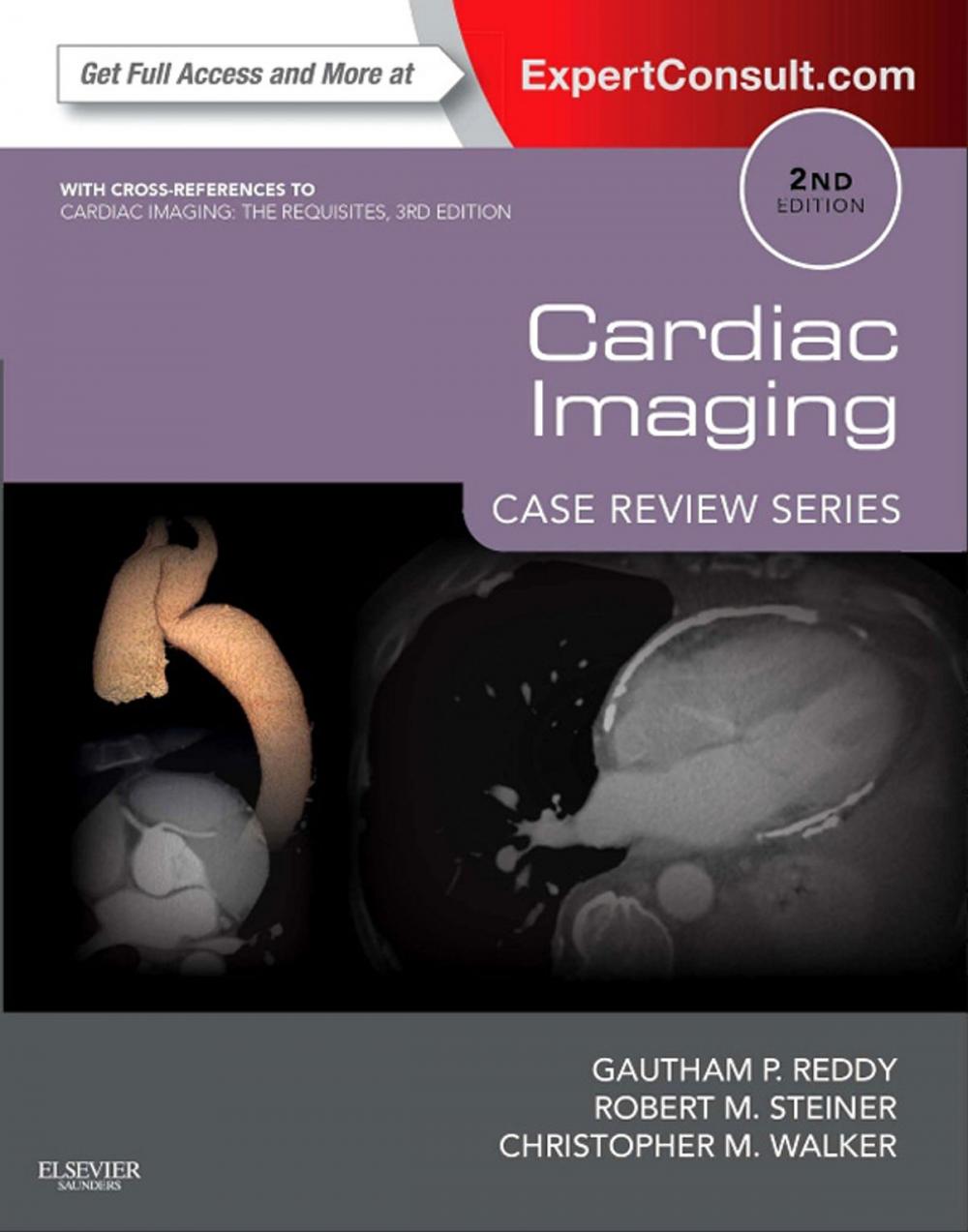 Big bigCover of Cardiac Imaging: Case Review Series E-Book