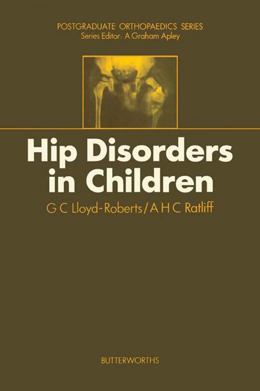 Big bigCover of Hip Disorders in Children