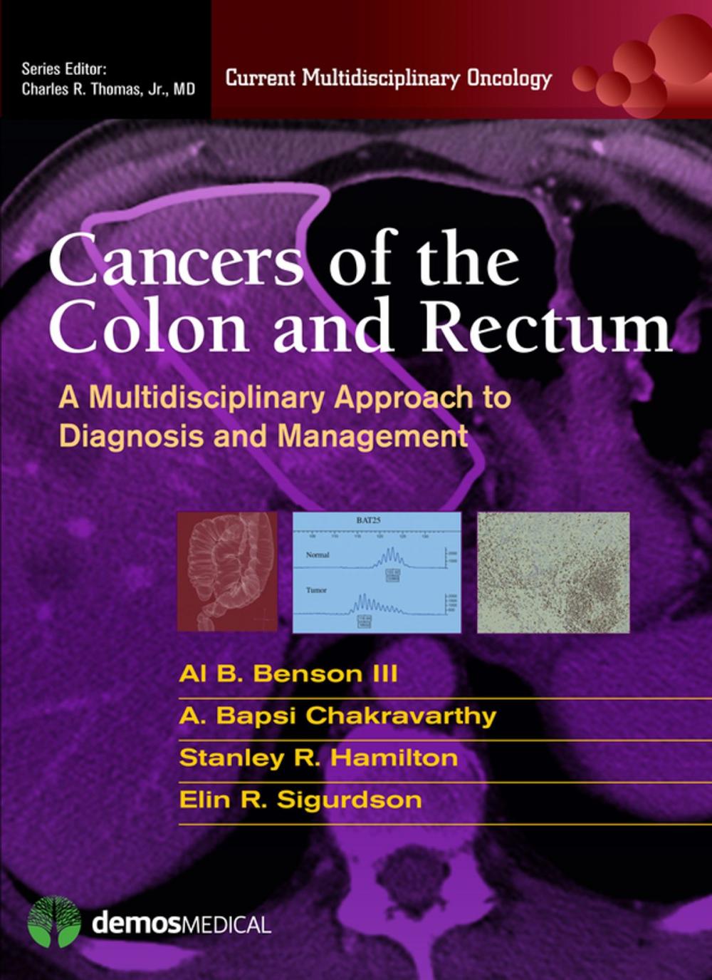 Big bigCover of Cancers of the Colon and Rectum