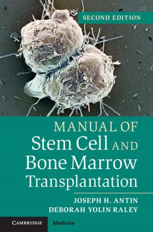 Cover of the book Manual of Stem Cell and Bone Marrow Transplantation by 