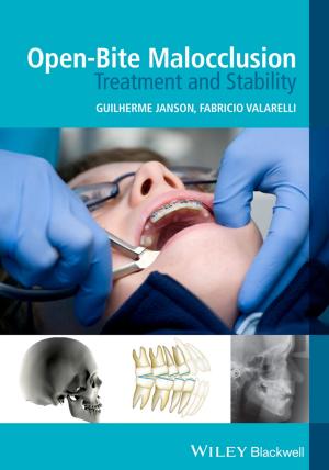 Cover of the book Open-Bite Malocclusion by Guy Wyser-Pratte