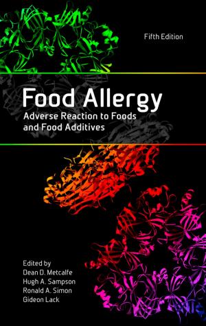 Cover of the book Food Allergy by Jonas Hall, Thomas Lingefjärd