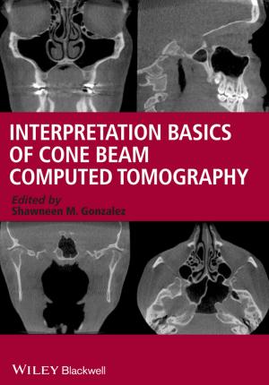 Cover of the book Interpretation Basics of Cone Beam Computed Tomography by Julie Meehan, Mike Simonetto, Larry Montan, Chris Goodin