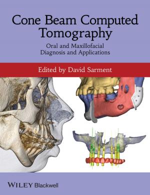 Cover of the book Cone Beam Computed Tomography by Tomasz Bielecki, Damiano Brigo, Frederic Patras