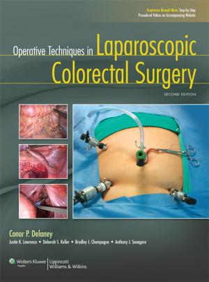 Cover of the book Operative Techniques in Laparoscopic Colorectal Surgery by Lisa Marcucci, Elizabeth A. Martinez, Elliott R. Haut, Anthony D. Slonim, Jose I. Suarez