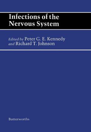 Cover of the book Infections of the Nervous System by James J. Licari, Laura A. Hughes