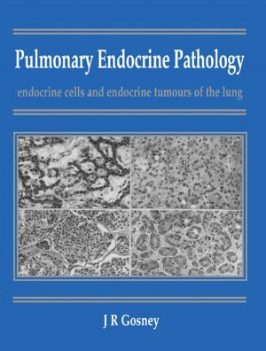 Cover of the book Pulmonary Endocrine Pathology by Lisa Byrd
