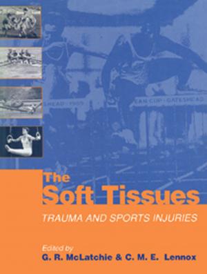 Cover of the book The Soft Tissues by Tony J. Cunha