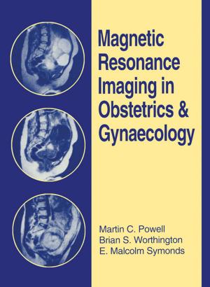 Book cover of Magnetic Resonance Imaging in Obstetrics and Gynaecology