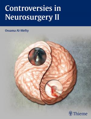 Cover of the book Controversies in Neurosurgery II by 