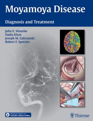 Cover of the book Moyamoya Disease by Andrew Blitzer, Brian E. Benson, Joel Guss