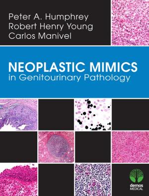 Cover of the book Neoplastic Mimics in Genitourinary Pathology by Robin Donohoe Dennison, DNP, APRN, CCNS, CEN, CNE, Anita Dempsey, PhD, APRN, PMHCNS-BC, John Rosselli, MS, RN, FNP-BC, CNE