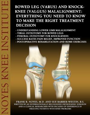 bigCover of the book Bowed Leg (Varus) and Knock-Knee (Valgus) Malalignment: Everything You Need to Know to Make the Right Treatment Decision by 