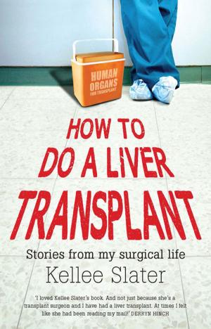 Cover of the book How to Do a Liver Transplant by John Blay