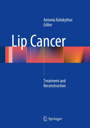 Cover of the book Lip Cancer by Peter Stoll, Gisela Dallenbach-Hellweg