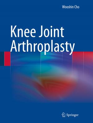 Cover of the book Knee Joint Arthroplasty by Shengqiang Yang, Wenhui Li