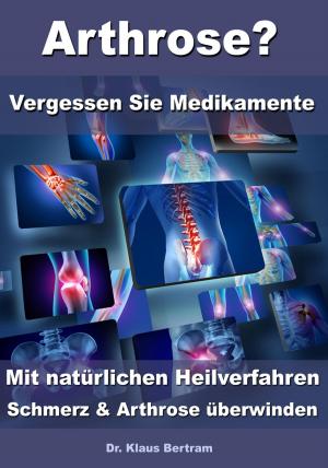 Book cover of Arthrose? – Vergessen Sie Medikamente – Mit natürlichen Heilverfahren Schmerz & Arthrose überwinden
