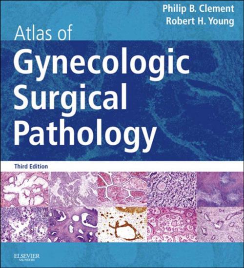 Cover of the book Atlas of Gynecologic Surgical Pathology E-Book by Philip B. Clement, MD, Robert H. Young, MD, FRCPath, Elsevier Health Sciences