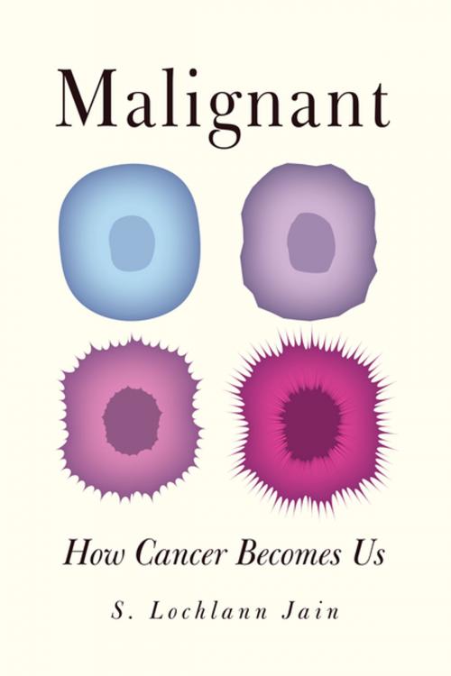Cover of the book Malignant by S. Lochlann Jain, University of California Press