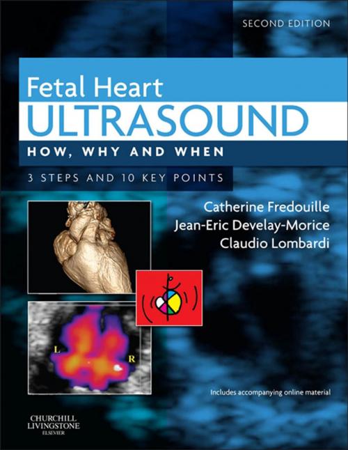 Cover of the book Fetal Heart Ultrasound - E-Book by Claudio Lombardi, Catherine Fredouille, MD, Jean-Eric Develay-Morice, MD, Elsevier Health Sciences