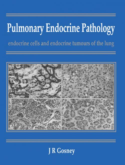 Cover of the book Pulmonary Endocrine Pathology by John R. Gosney, Elsevier Science