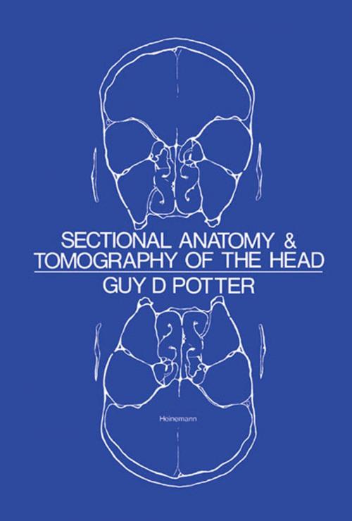 Cover of the book Sectional Anatomy and Tomography of the Head by Guy D. Potter, Elsevier Science