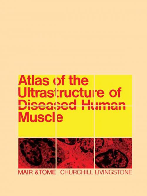 Cover of the book Atlas of the Ultrastructure of Diseased Human Muscle by W G P Mair, F M S Tomé, Elsevier Science