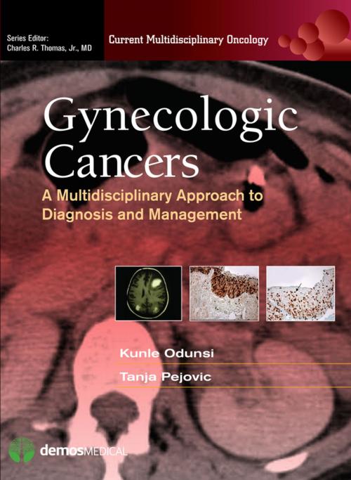 Cover of the book Gynecologic Cancers by Charles R. Thomas Jr., MD, Springer Publishing Company