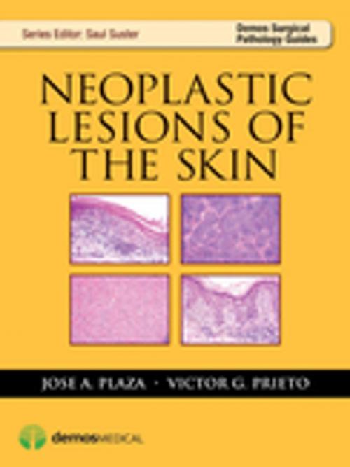 Cover of the book Neoplastic Lesions of the Skin by Jose Plaza, MD, Victor Prieto, MD, Saul Suster, MD, Springer Publishing Company