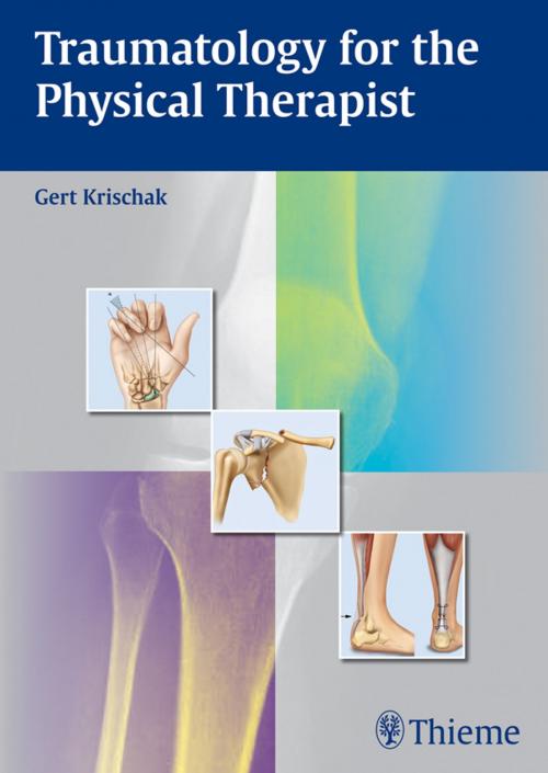 Cover of the book Traumatology for the Physical Therapist by Gert Krischak, Thieme