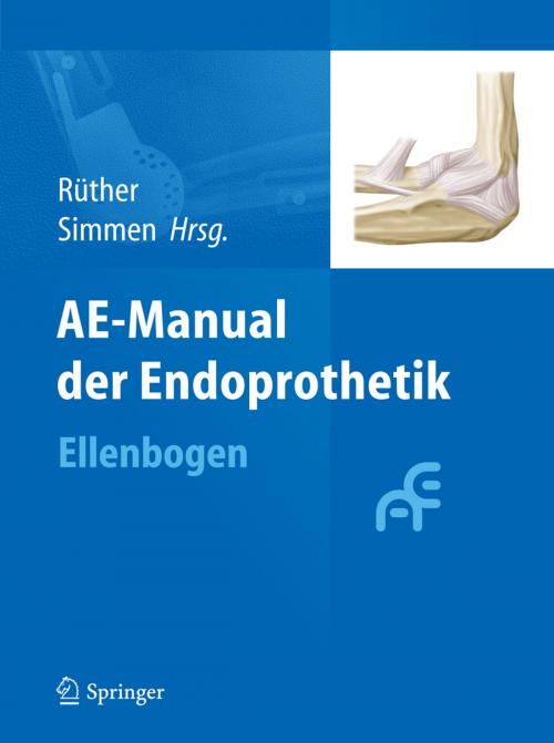 Cover of the book AE-Manual der Endoprothetik by , Springer Berlin Heidelberg