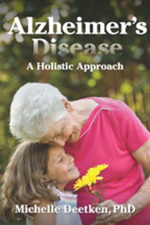 bigCover of the book Alzheimer's Disease by 