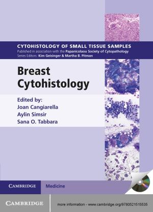 Cover of the book Breast Cytohistology by Vladimir A. Rakov