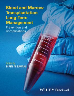 Cover of the book Blood and Marrow Transplantation Long-Term Management by René Guinebretière