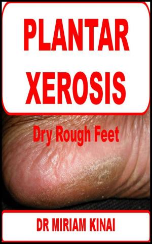 Book cover of Plantar Xerosis