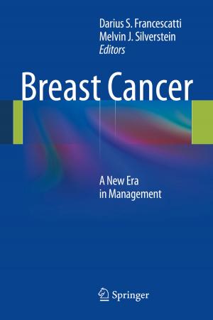 Cover of the book Breast Cancer by Sotirios E. Louridas, Michael Th. Rassias