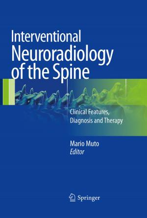 Cover of the book Interventional Neuroradiology of the Spine by Ivan Nourdin