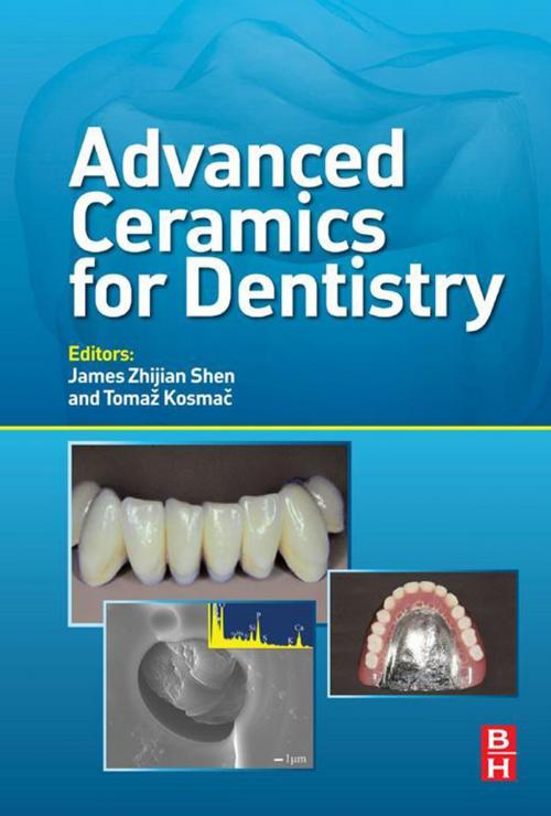 Cover of the book Advanced Ceramics for Dentistry by , Elsevier Science